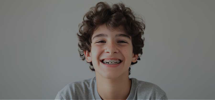 Orthodonic Braces Orthodonic Braces